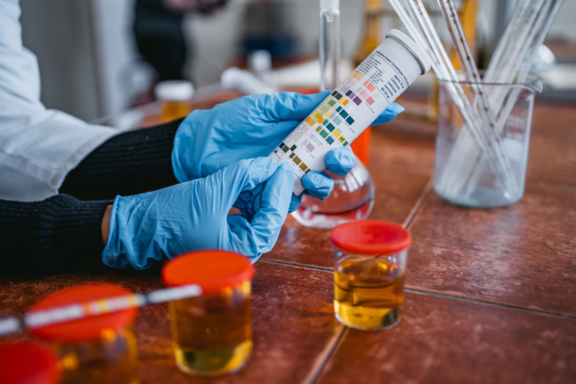 Practitioner measuring pH test strips of urine sample